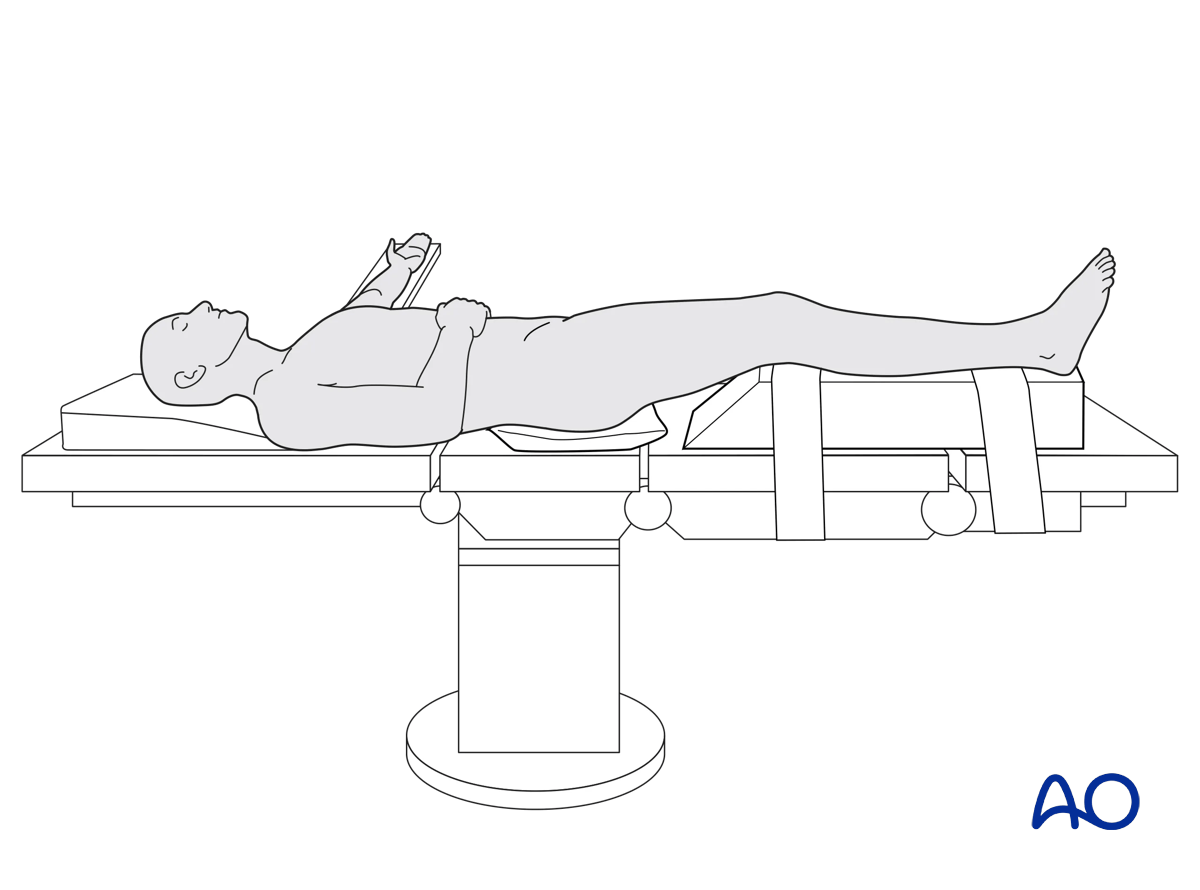 Patient positioning, supine