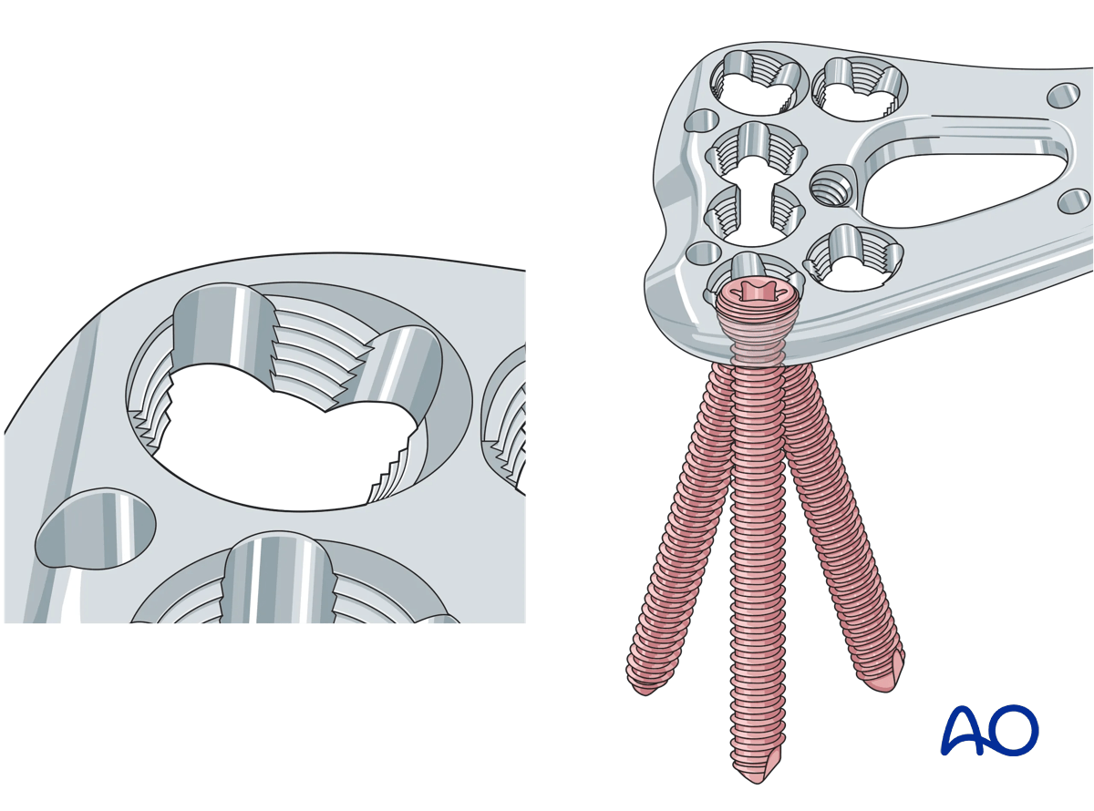 Polyaxial screws