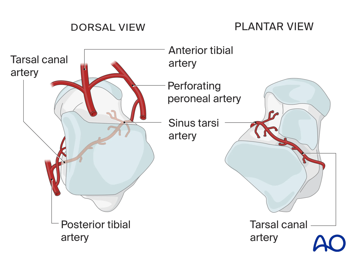 Artery of the tarsal canal supplying talar body and minimal lateral contribution from peroneal artery