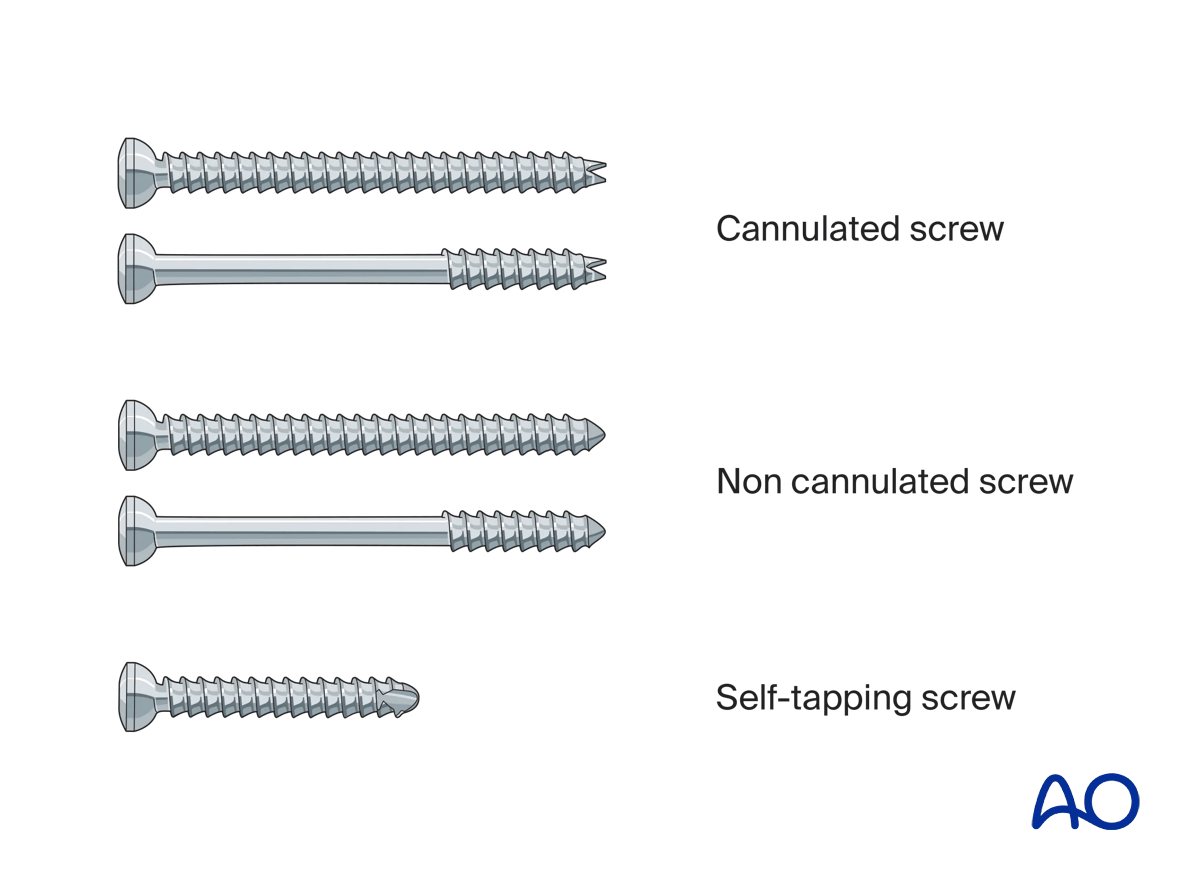 Various lag screws