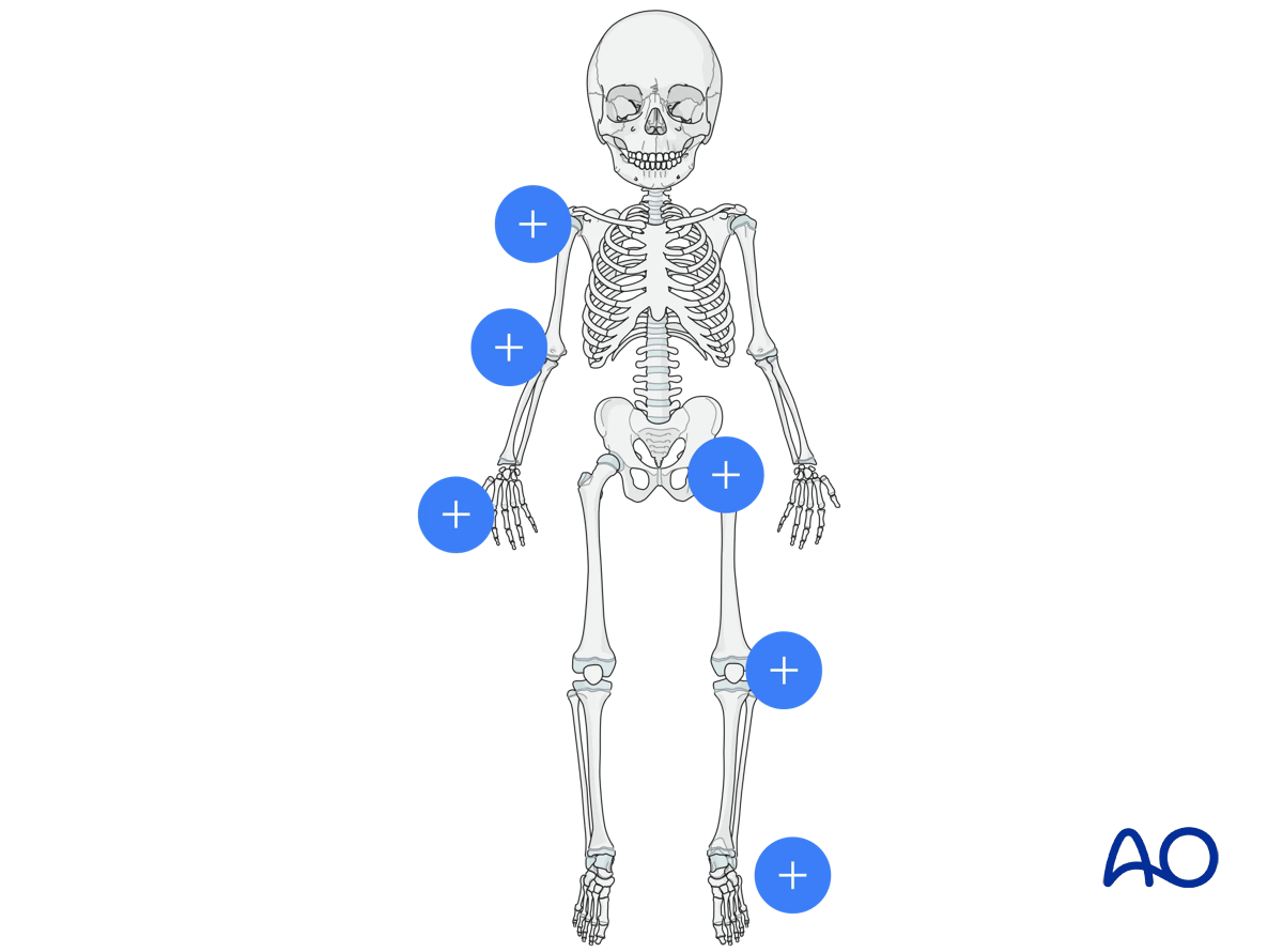 Pediatric skeleton