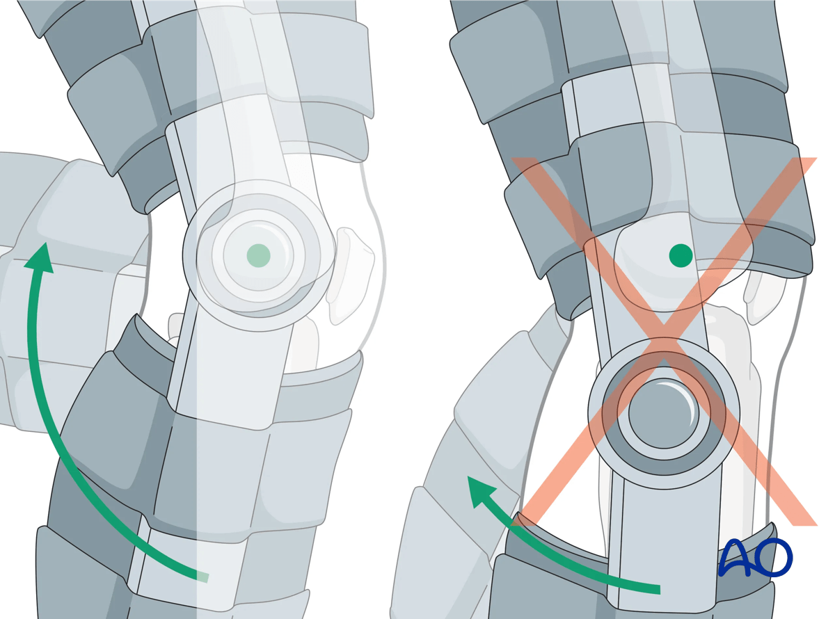Hinged fracture brace