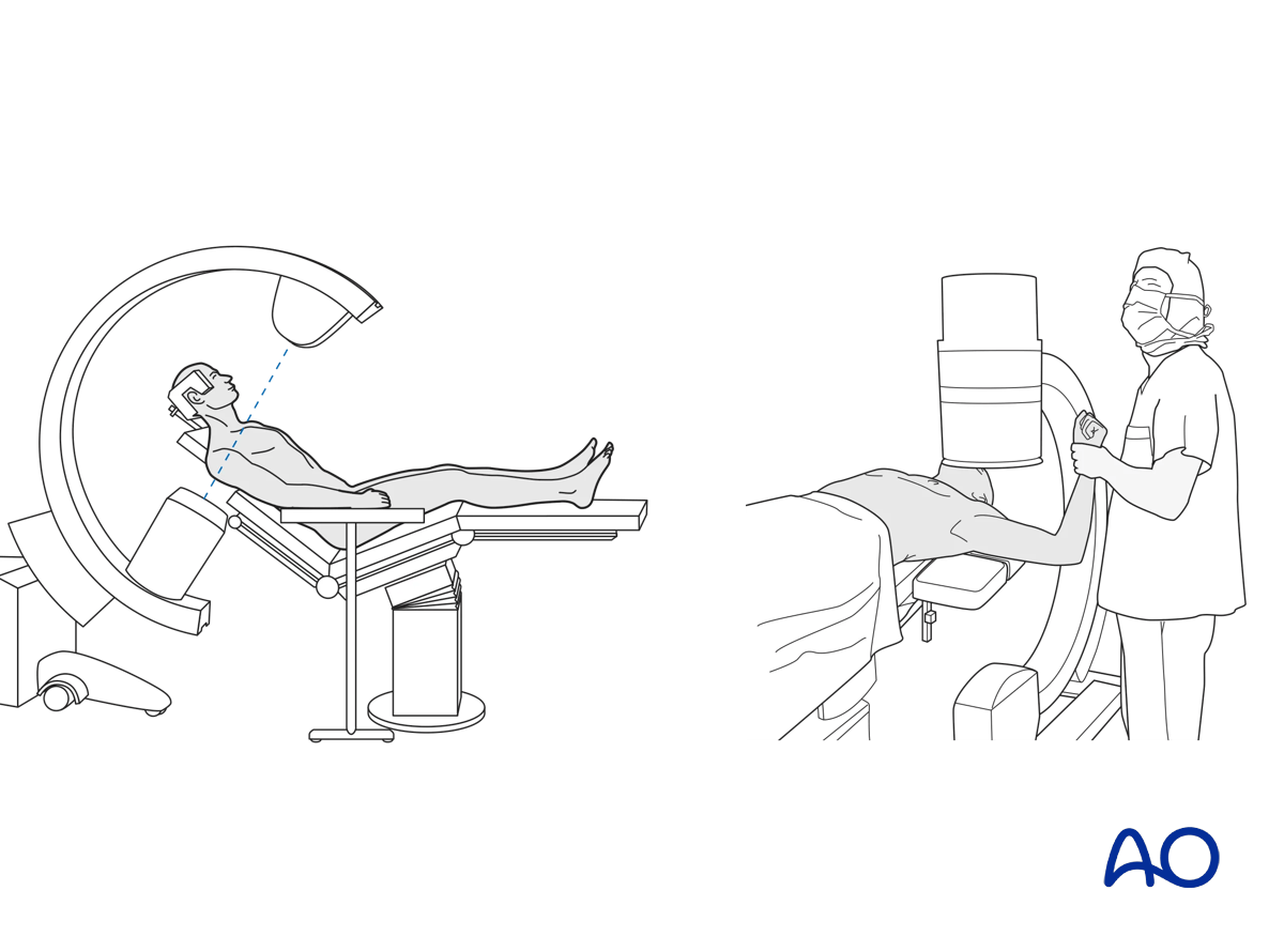C-arm positioning for intraoperative imaging in shoulder surgery