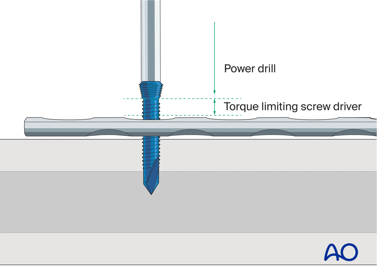 Insertion of self-drilling screw