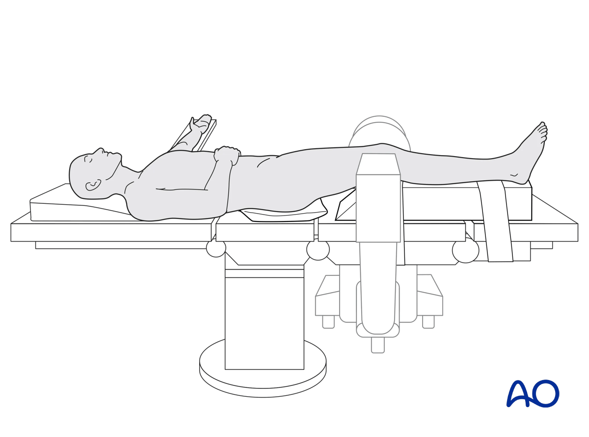 supine position, c-arm positioning