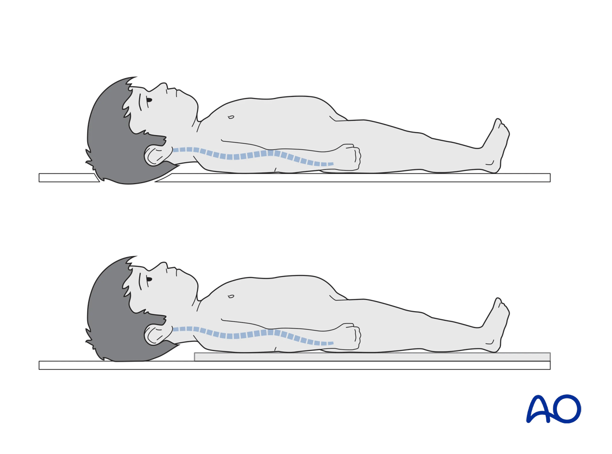 Supine positioning of a pediatric patient