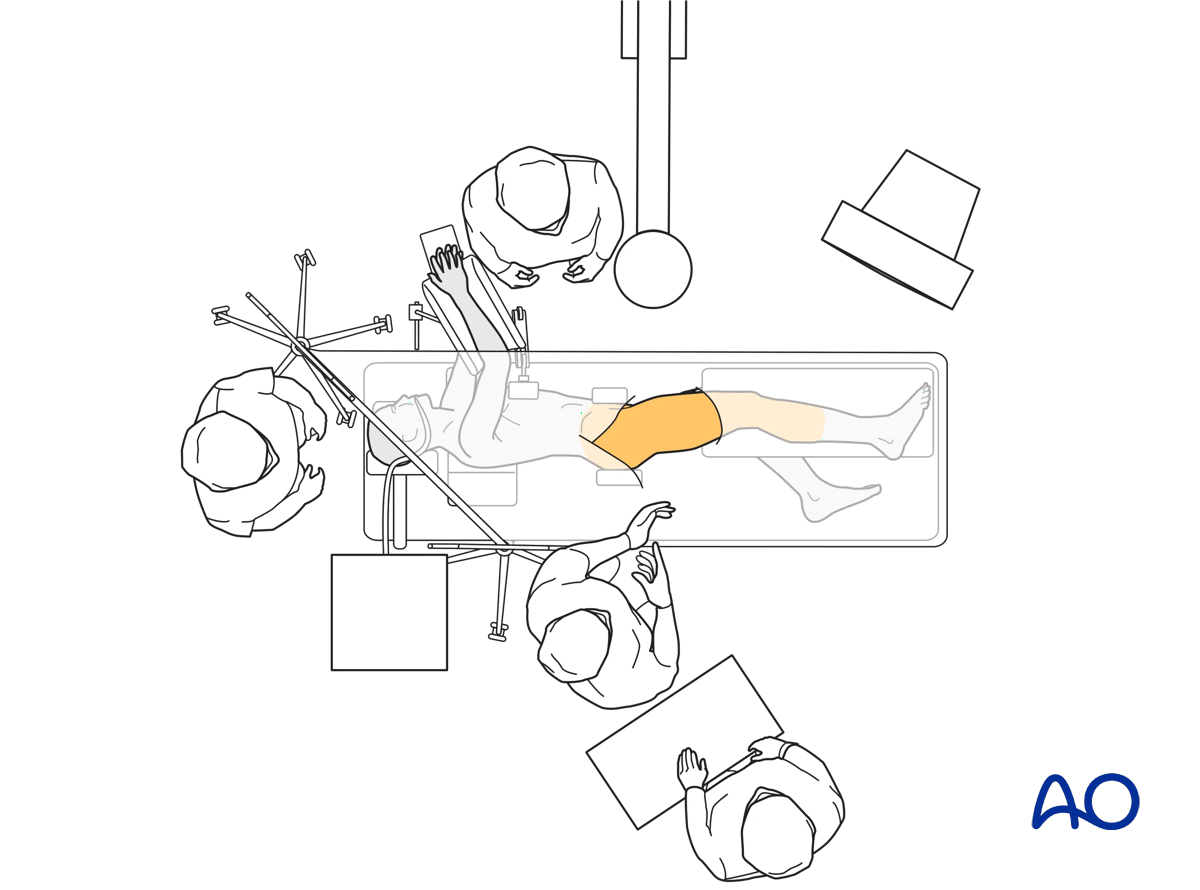 Operating room setup for hip sugery