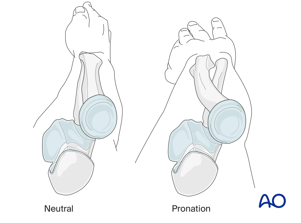 Forearm position pronation and neutral rotation