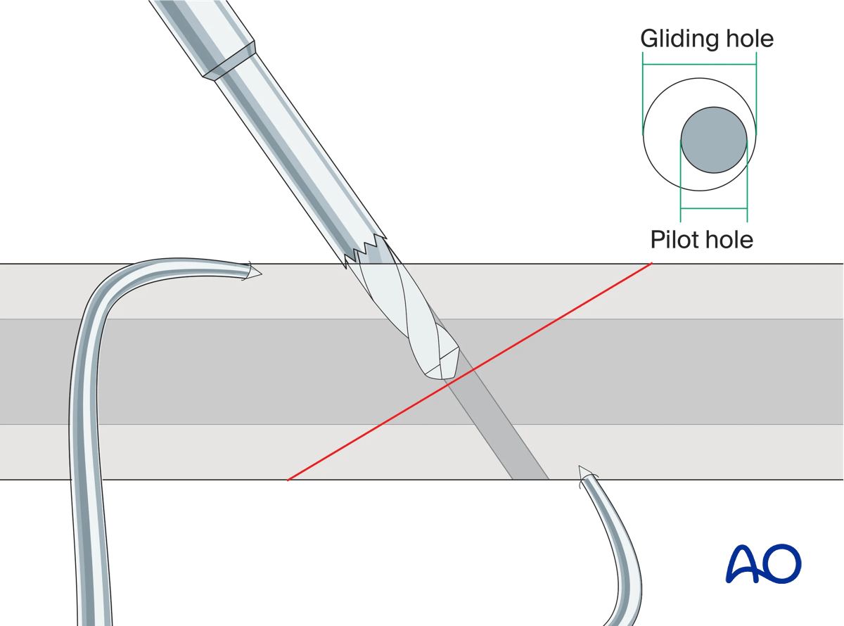 Alternative drilling technique