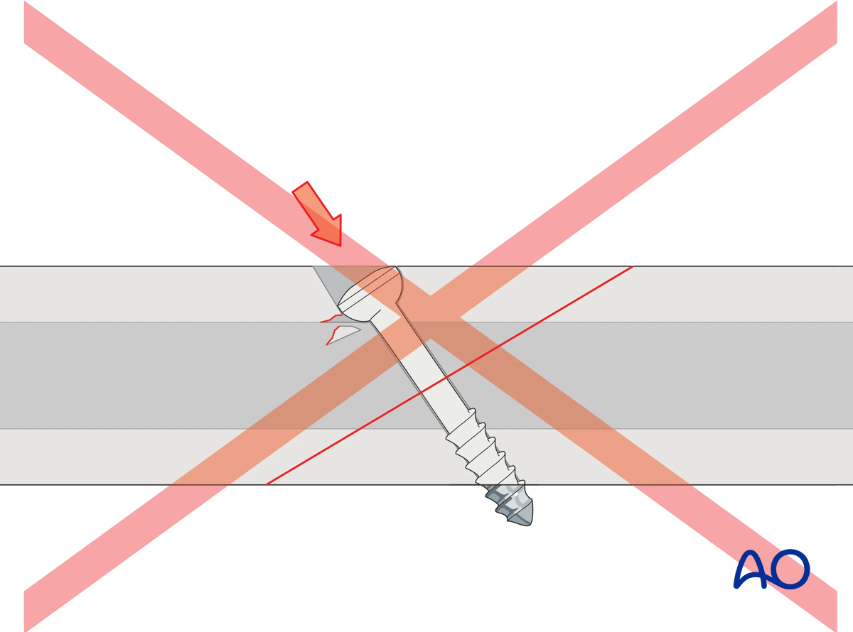 Use of dished washer