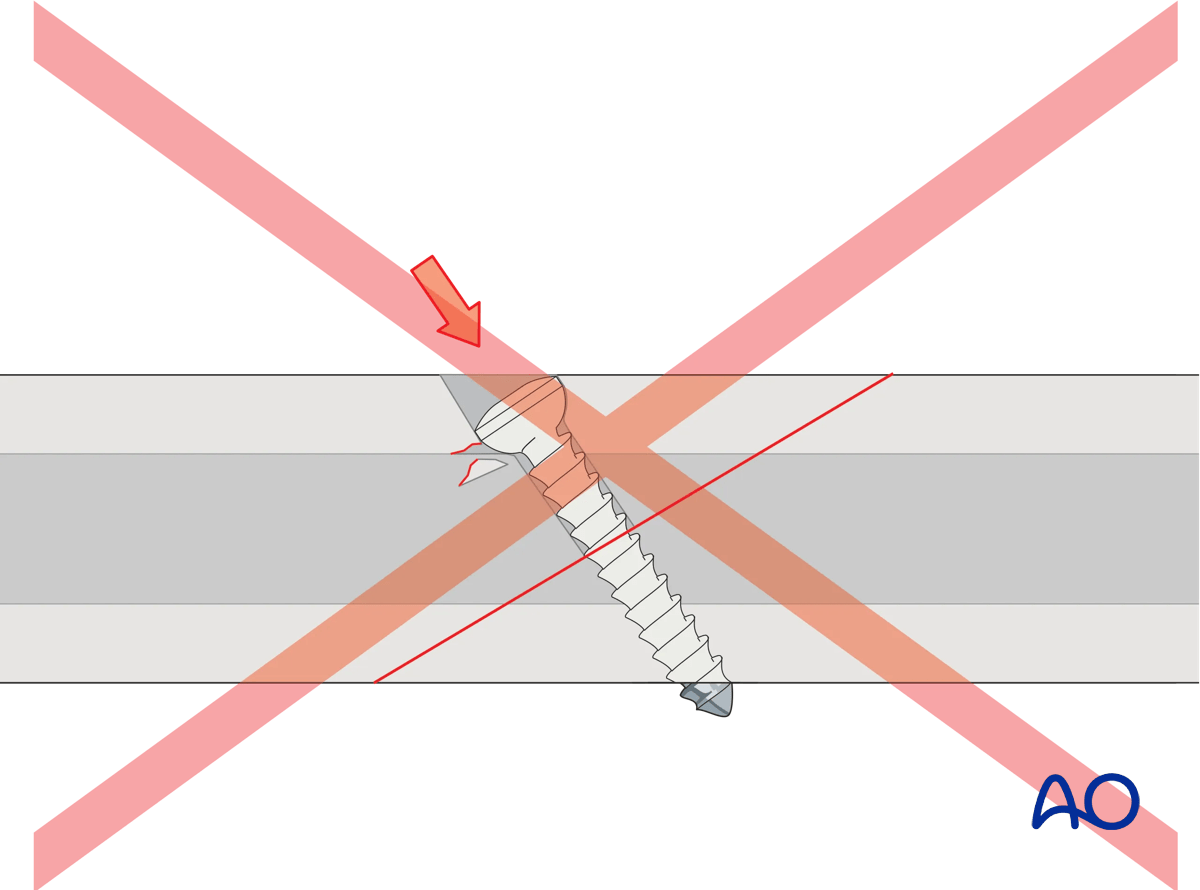 Pitfall when countersinking
