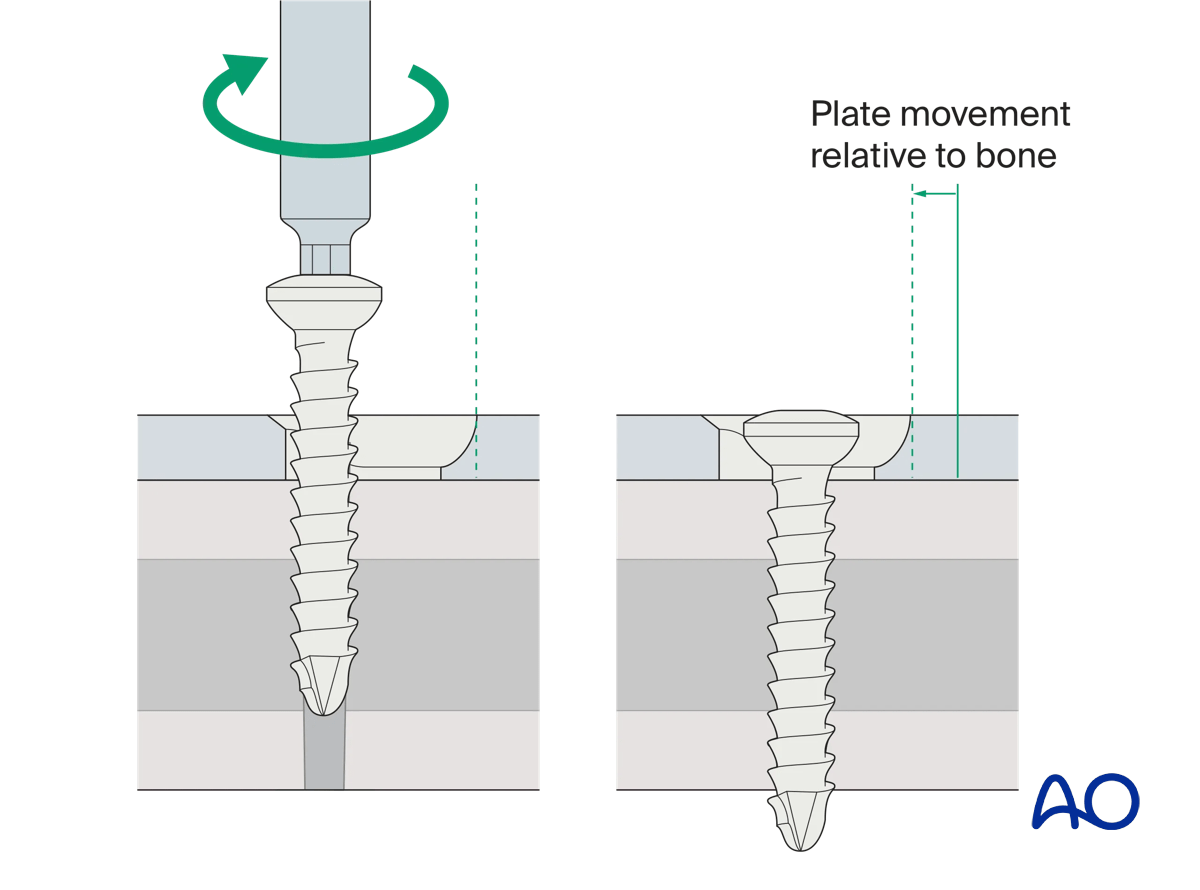 Principle of dynamic compression
