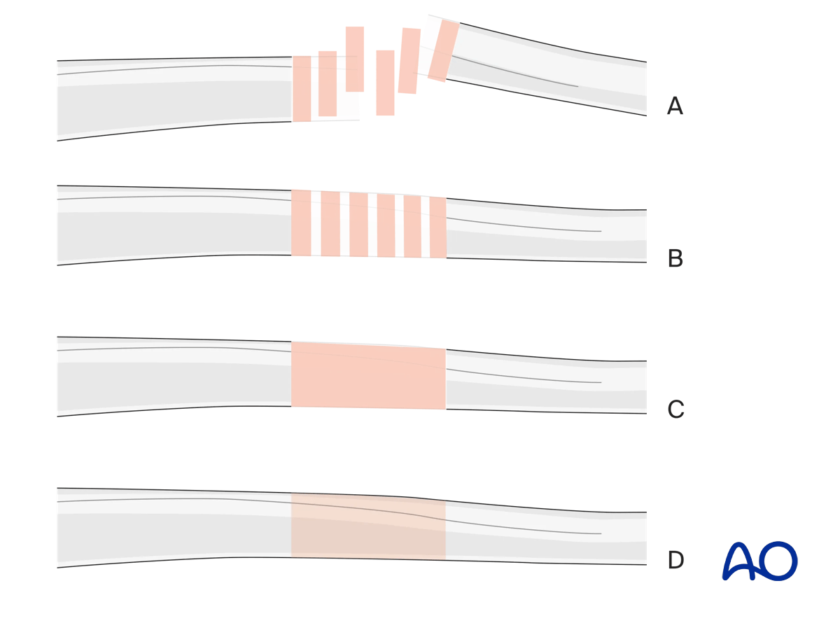 Generic fracture patterns