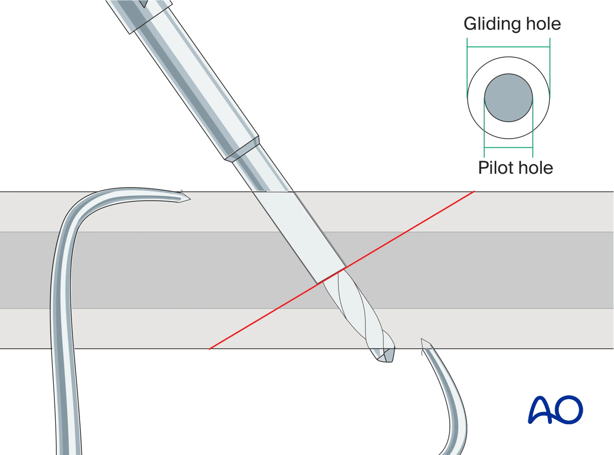 Drilling of pilot hole