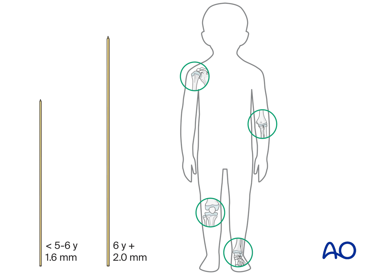 K-wire size