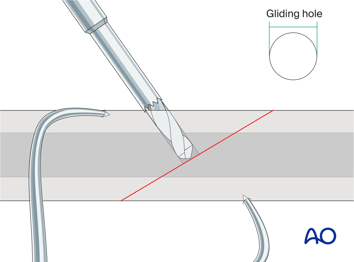 Drilling of gliding hole
